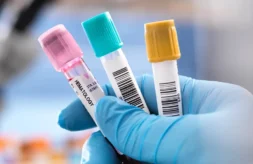 A gloved hand holds medical blood sample tubes with labels, representing laboratory testing.