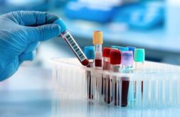 A gloved hand places a blood sample test tube with a barcode label into a rack with several other tubes.
