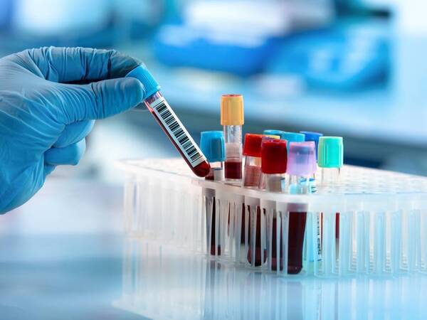 A gloved hand places a blood sample test tube with a barcode label into a rack with several other tubes.
